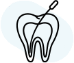 root canal2